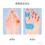 跨境预分切弹力护脚趾防磨肌内效贴大脚趾外翻固定支撑运动绷带胶