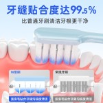 新款正畸牙刷W型正畸牙刷软毛牙齿戴牙套箍牙清洁搭配牙缝牙间刷