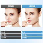 寻秋微电流瘦脸神器彩光嫩肤双下巴美容仪震动面部提拉V脸瘦脸仪