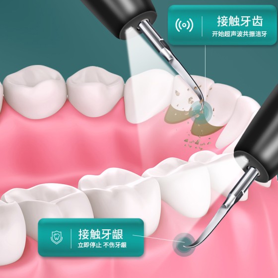 超声波家用洁牙器洗牙齿神器清洁美牙仪洗牙器去除牙结石美白牙垢