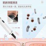 EMS铲皮刀正负离子面部导入导出黑头油脂毛孔清洁仪超声波铲皮机